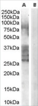 Anti-ADAM33 antibody produced in goat affinity isolated antibody, buffered aqueous solution