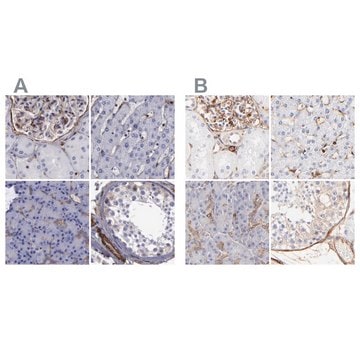 Anti-FLNA antibody produced in rabbit Ab2, Prestige Antibodies&#174; Powered by Atlas Antibodies, affinity isolated antibody, buffered aqueous glycerol solution