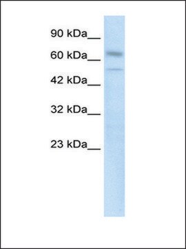 Anti-ZNF306 antibody produced in rabbit affinity isolated antibody