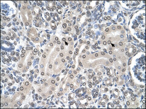 Anti-SHMT2 (AB1) antibody produced in rabbit affinity isolated antibody