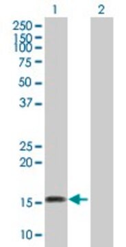 Anti-ARMET antibody produced in mouse purified immunoglobulin, buffered aqueous solution