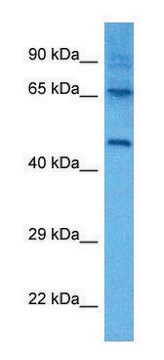 Anti-LTBR (C-terminal) antibody produced in rabbit affinity isolated antibody