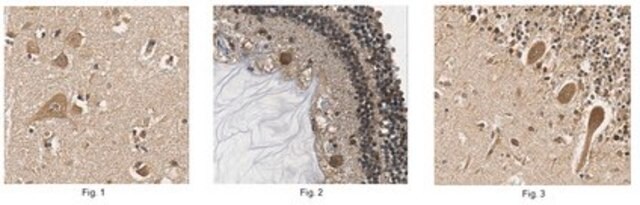 Anti-Myelin Regulatory Factor (MRF) Antibody 1.0&#160;mg/mL, from rabbit