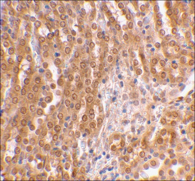 Anti-TIRP (ab2) antibody produced in rabbit affinity isolated antibody, buffered aqueous solution