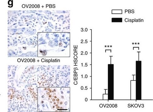 Anti-C/EBP-&#946; antibody produced in rabbit affinity isolated antibody