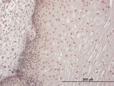 Anti-CBFA2T3 antibody produced in mouse purified immunoglobulin, buffered aqueous solution