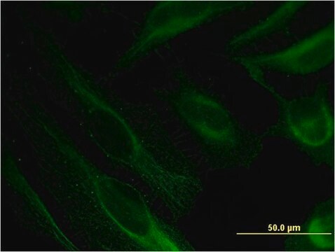 Monoclonal Anti-BST2 antibody produced in mouse clone 2E6, purified immunoglobulin, buffered aqueous solution