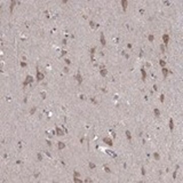 Anti-IDS antibody produced in rabbit Prestige Antibodies&#174; Powered by Atlas Antibodies, affinity isolated antibody, buffered aqueous glycerol solution