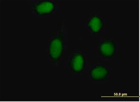 Anti-WHSC1L1 antibody produced in mouse purified immunoglobulin, buffered aqueous solution