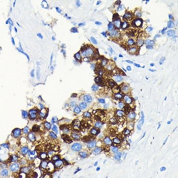 Anti-C-Reactive Protein (CRP) antibody produced in rabbit