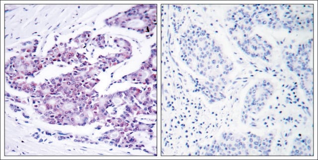 Anti-RELA (Ab-468) antibody produced in rabbit affinity isolated antibody