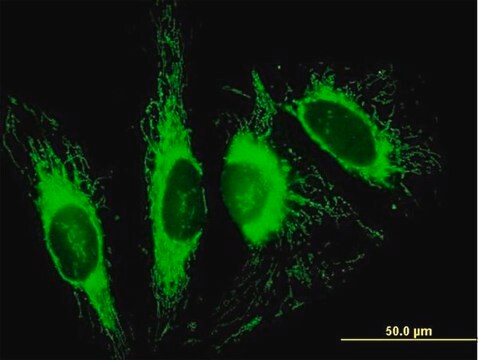 Anti-TOMM70A antibody produced in mouse purified immunoglobulin, buffered aqueous solution