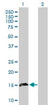 Anti-TPD52L3 antibody produced in mouse purified immunoglobulin, buffered aqueous solution