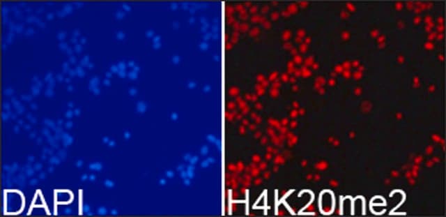 Anti-Histone H4K20me2 antibody produced in rabbit affinity isolated antibody