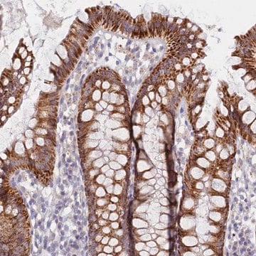 Anti-C6orf223 antibody produced in rabbit Prestige Antibodies&#174; Powered by Atlas Antibodies, affinity isolated antibody, buffered aqueous glycerol solution