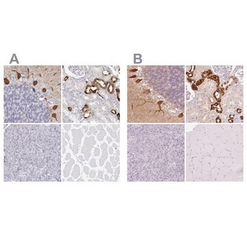 Anti-CALB1 antibody produced in rabbit Prestige Antibodies&#174; Powered by Atlas Antibodies, affinity isolated antibody, buffered aqueous glycerol solution