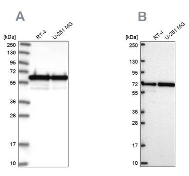 Anti-CCDC47 antibody produced in rabbit Prestige Antibodies&#174; Powered by Atlas Antibodies, affinity isolated antibody, buffered aqueous glycerol solution