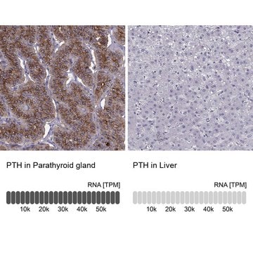 Anti-PTH antibody produced in rabbit Prestige Antibodies&#174; Powered by Atlas Antibodies, affinity isolated antibody