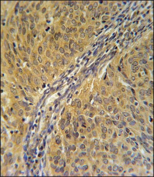 ANTI-DYNC1LI2 (CENTER) antibody produced in rabbit IgG fraction of antiserum, buffered aqueous solution