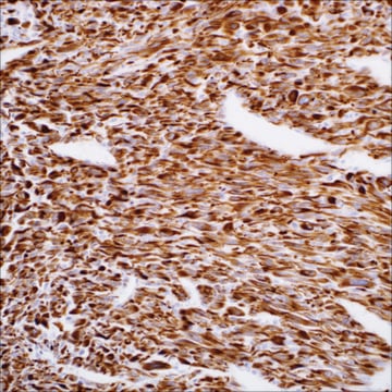 Desmin (EP15) Rabbit Monoclonal Primary Antibody