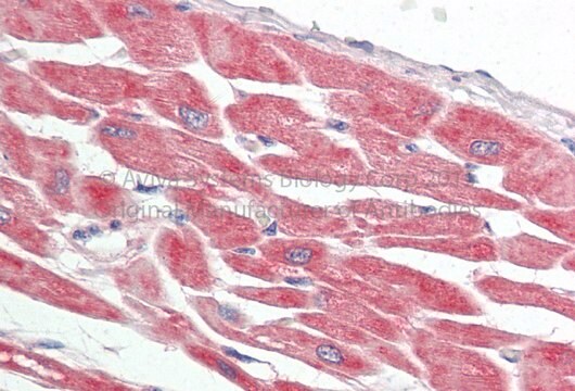 Anti-PRKACA (N-terminal) antibody produced in rabbit affinity isolated antibody