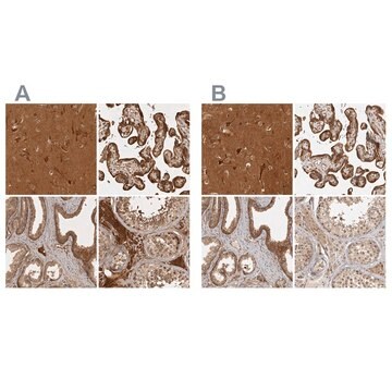 Anti-CAMSAP2 antibody produced in rabbit Prestige Antibodies&#174; Powered by Atlas Antibodies, affinity isolated antibody, buffered aqueous glycerol solution, Ab2