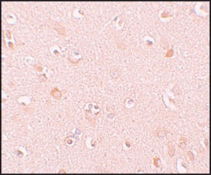 Anti-NALP5 antibody produced in rabbit affinity isolated antibody, buffered aqueous solution