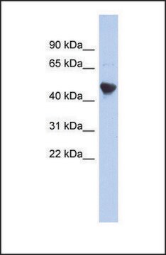 Anti-IER5L antibody produced in rabbit affinity isolated antibody