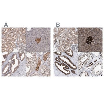 Anti-ACLY antibody produced in rabbit Prestige Antibodies&#174; Powered by Atlas Antibodies, affinity isolated antibody, buffered aqueous glycerol solution