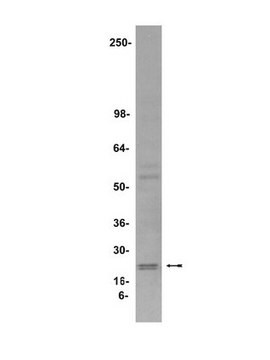 Anti-Endostatin Antibody, clone 1837.46 clone 1837.46, Upstate&#174;, from mouse