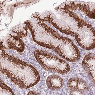 Anti-ZNF425 antibody produced in rabbit Prestige Antibodies&#174; Powered by Atlas Antibodies, affinity isolated antibody, buffered aqueous glycerol solution