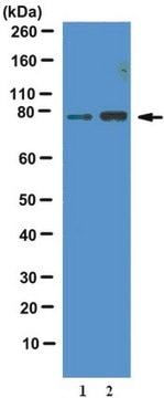 Anti-phospho-FOXO1 Antibody (Thr24) from rabbit, purified by affinity chromatography