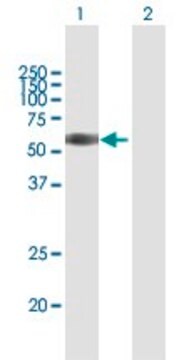 抗TNFRSF1B抗体 マウス宿主抗体 purified immunoglobulin, buffered aqueous solution