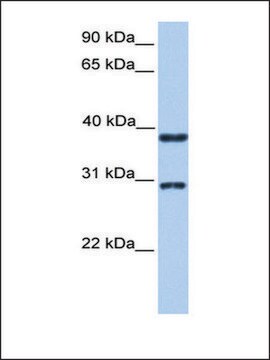 Anti-KLHDC1 antibody produced in rabbit affinity isolated antibody