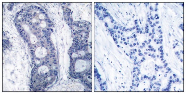 Anti-EIF4E antibody produced in rabbit affinity isolated antibody