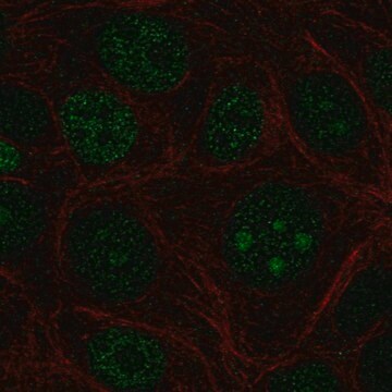 Anti-ZBTB14 antibody produced in rabbit Prestige Antibodies&#174; Powered by Atlas Antibodies, affinity isolated antibody