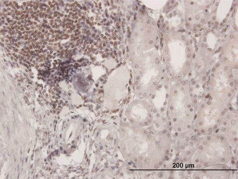 Anti-SP110 antibody produced in mouse purified immunoglobulin, buffered aqueous solution