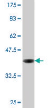 Monoclonal Anti-CRYAB antibody produced in mouse clone 4E8-1C5, purified immunoglobulin, buffered aqueous solution