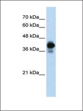 Anti-HNRPC antibody produced in rabbit affinity isolated antibody