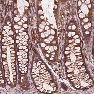 Anti-CCDC71L antibody produced in rabbit Prestige Antibodies&#174; Powered by Atlas Antibodies, affinity isolated antibody, buffered aqueous glycerol solution