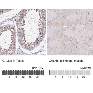 Anti-GALNS Prestige Antibodies&#174; Powered by Atlas Antibodies, affinity isolated antibody