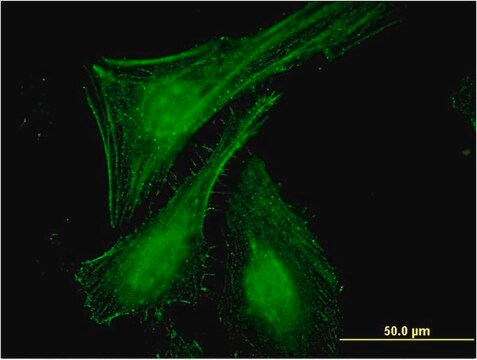 Monoclonal Anti-SLC27A2 antibody produced in mouse clone 1F1, purified immunoglobulin, buffered aqueous solution