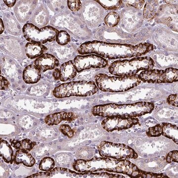 Anti-PRAMEF7 antibody produced in rabbit Prestige Antibodies&#174; Powered by Atlas Antibodies, affinity isolated antibody, buffered aqueous glycerol solution