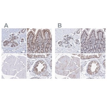 Anti-SF3B6 antibody produced in rabbit Prestige Antibodies&#174; Powered by Atlas Antibodies, affinity isolated antibody, buffered aqueous glycerol solution