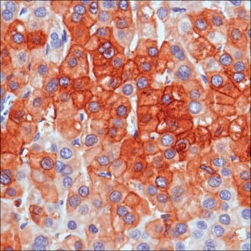 Anti-C-TEN antibody, Rabbit monoclonal recombinant, expressed in proprietary host, clone SP83, affinity isolated antibody