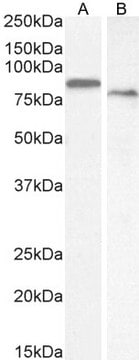 Anti-TGM2 antibody produced in goat affinity isolated antibody, buffered aqueous solution