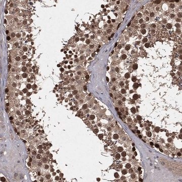 Anti-Fbxo7 Antibody Produced In Rabbit Prestige Antibodies&#174; Powered by Atlas Antibodies, affinity isolated antibody, buffered aqueous glycerol solution