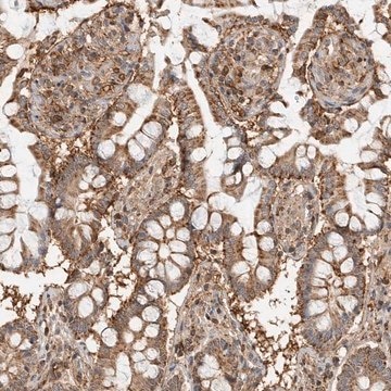 Anti-ANXA11 antibody produced in rabbit Prestige Antibodies&#174; Powered by Atlas Antibodies, affinity isolated antibody, buffered aqueous glycerol solution