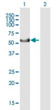 ANTI-KRT39 antibody produced in mouse purified immunoglobulin, buffered aqueous solution