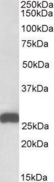 Anti-ETFB (C-terminal) antibody produced in goat affinity isolated antibody, buffered aqueous solution